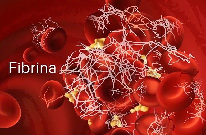 fibrina